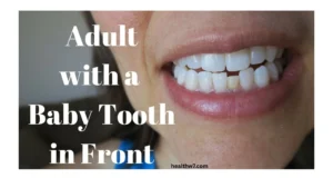 adult-with-baby-teeth