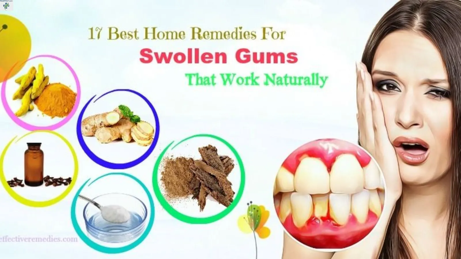 natural-remedies-for-swollen-gums