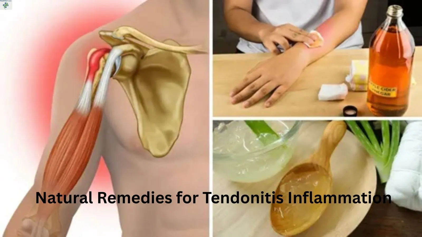 natural-remedies-for-tendonitis-inflammation