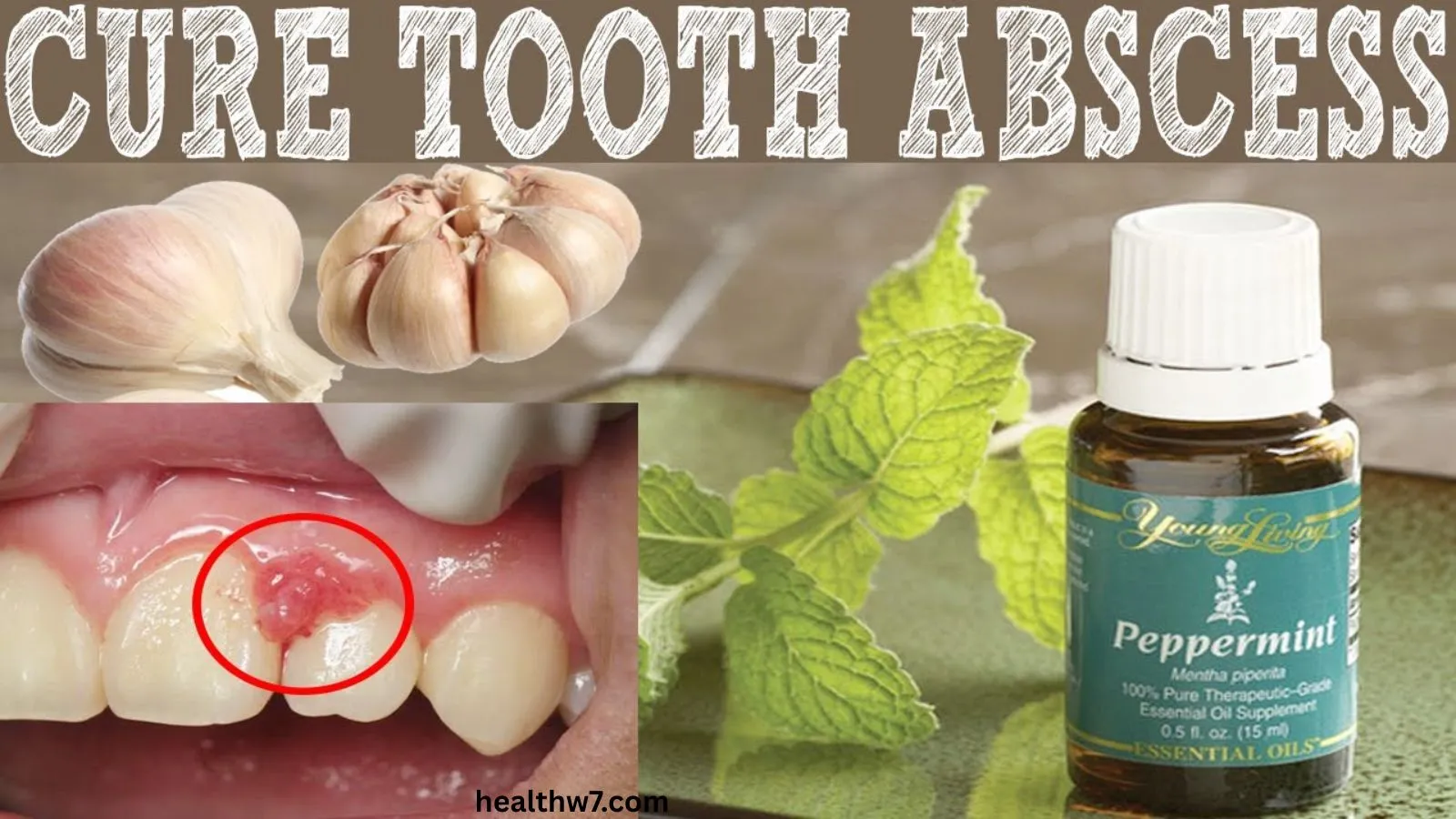 natural-remedies-for-abscess-tooth-relief-fast