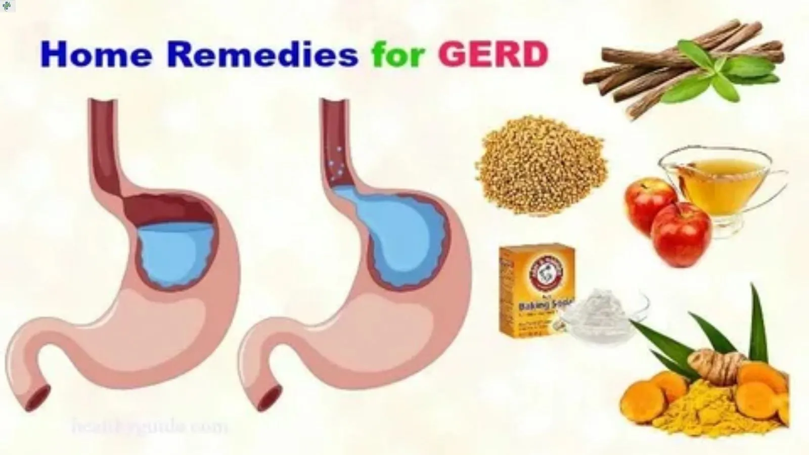 natural-remedies-for-infant-gerd