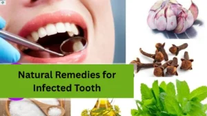 natural-remedies-for-infected-tooth