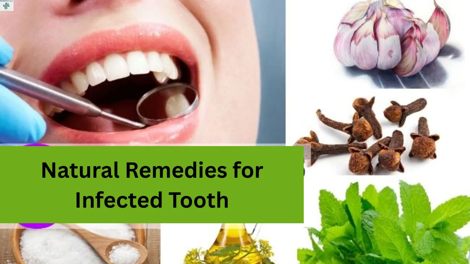 natural-remedies-for-infected-tooth