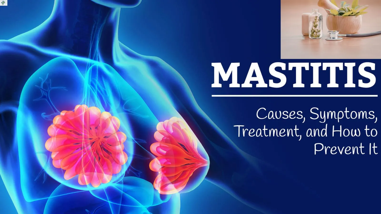 natural-remedies-for-mastitis