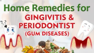 natural-remedies-for-periodontitis