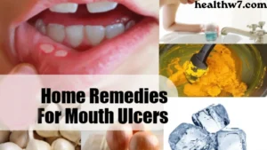 natural-remedy-for-mouth-blisters
