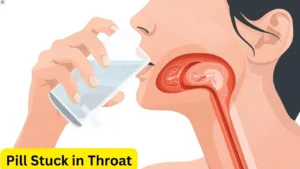 pill-stuck-in-throat