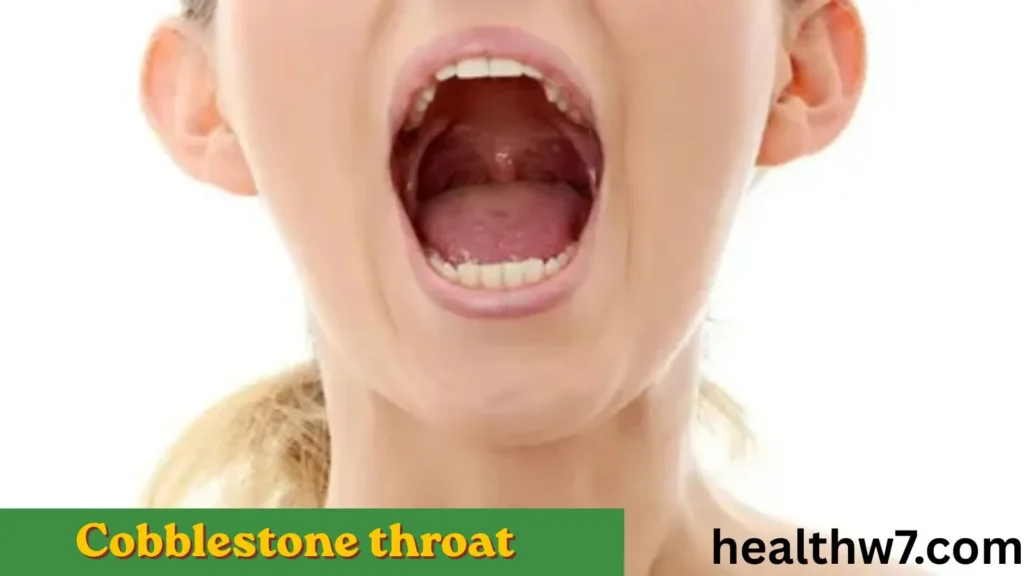 cobblestone-throat