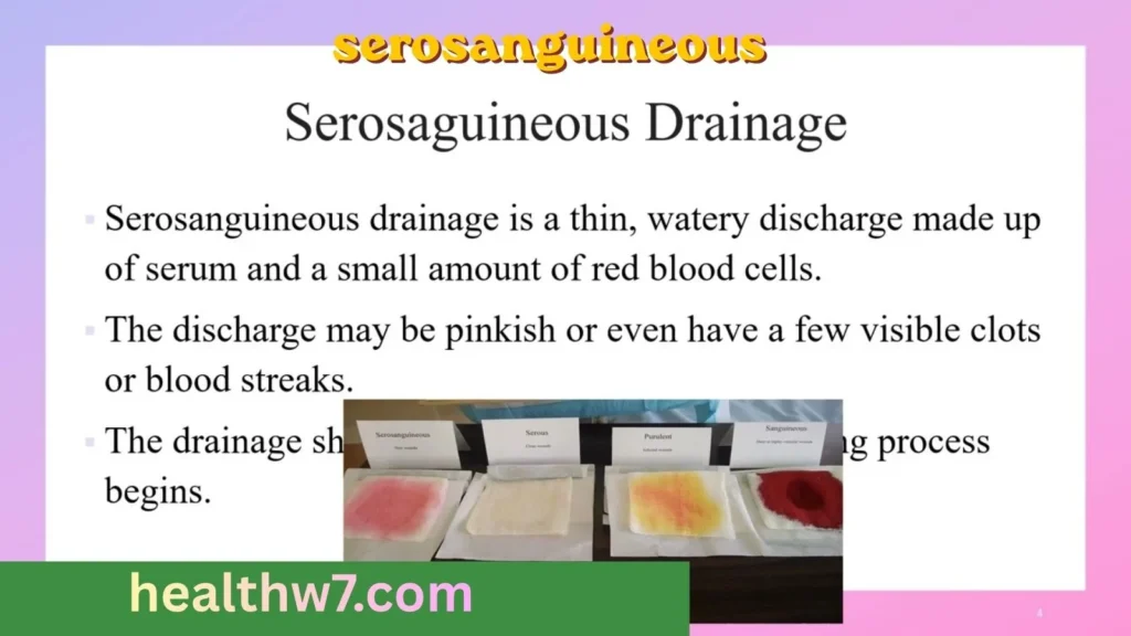 serosanguineous